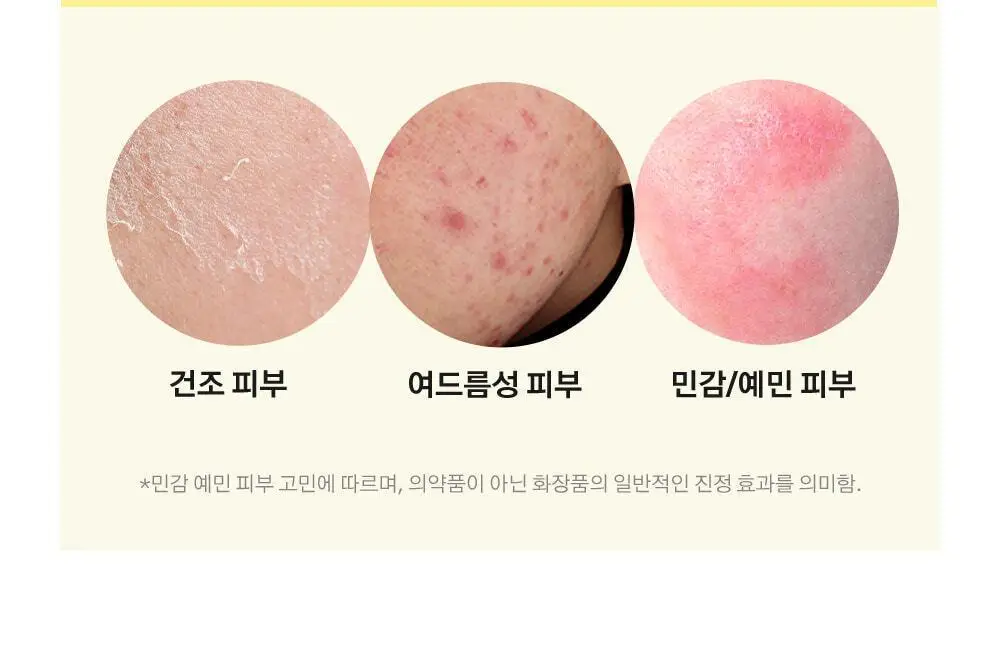 [수분결광 / 예민한피부] 오어스 민들레 진정 토너패드 90매 상세페이지 19